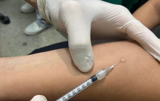 Rede de Manaus amplia rastreamento de infecção latente por tuberculose